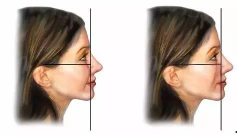 苹果肌照片,美丽轮廓的秘密武器